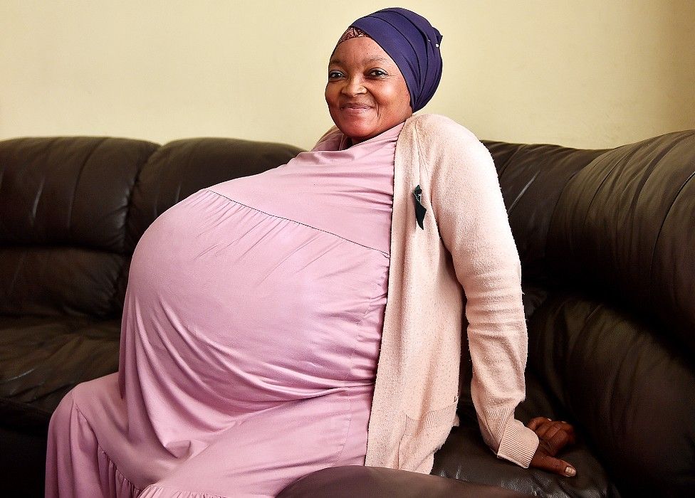 दक्षिण अफ्रिकाकी महिलाले एकै पटकमा १० बच्चा जन्माएको कुरा झुठो